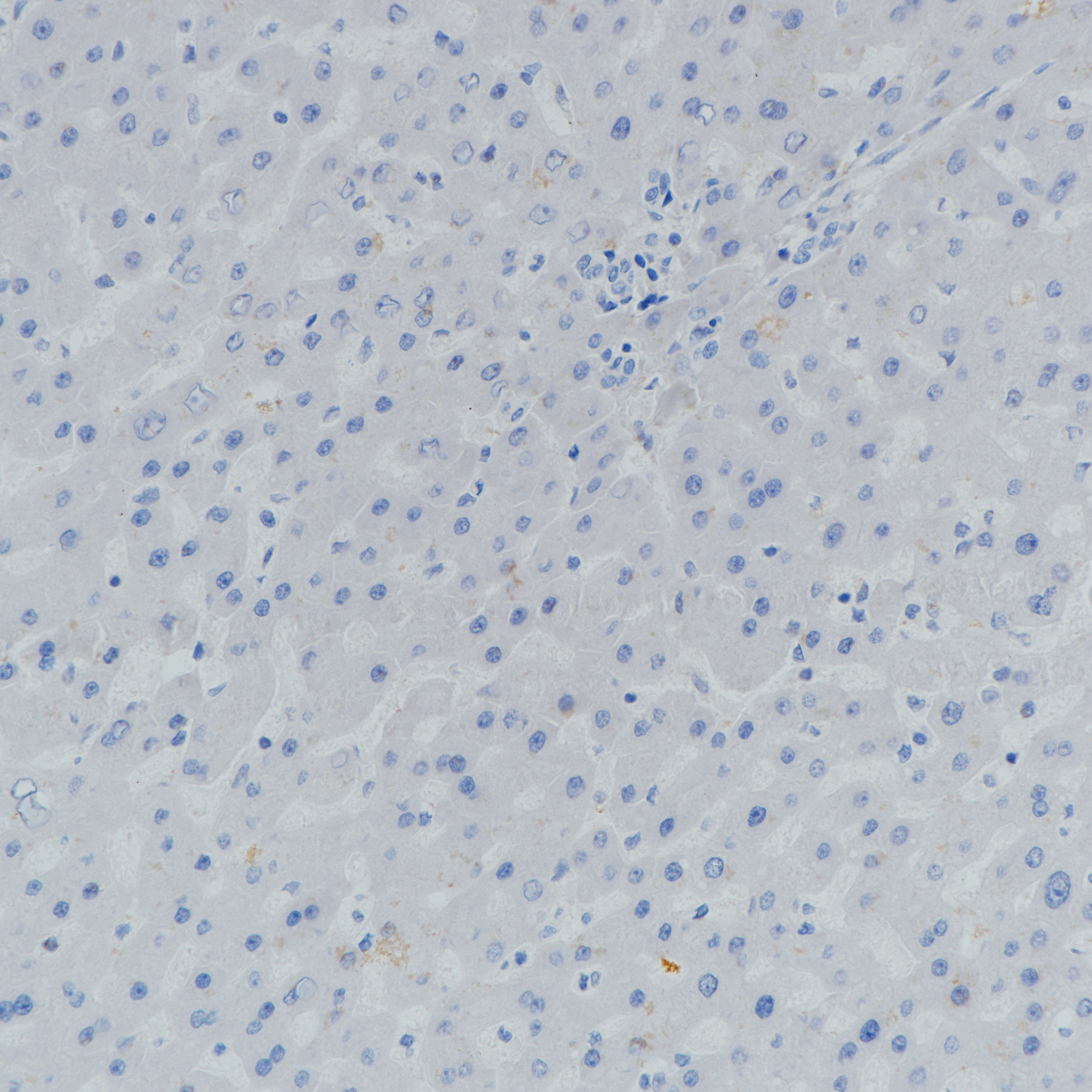 pan-TRK(EPR17341)肝 阴性组织染色