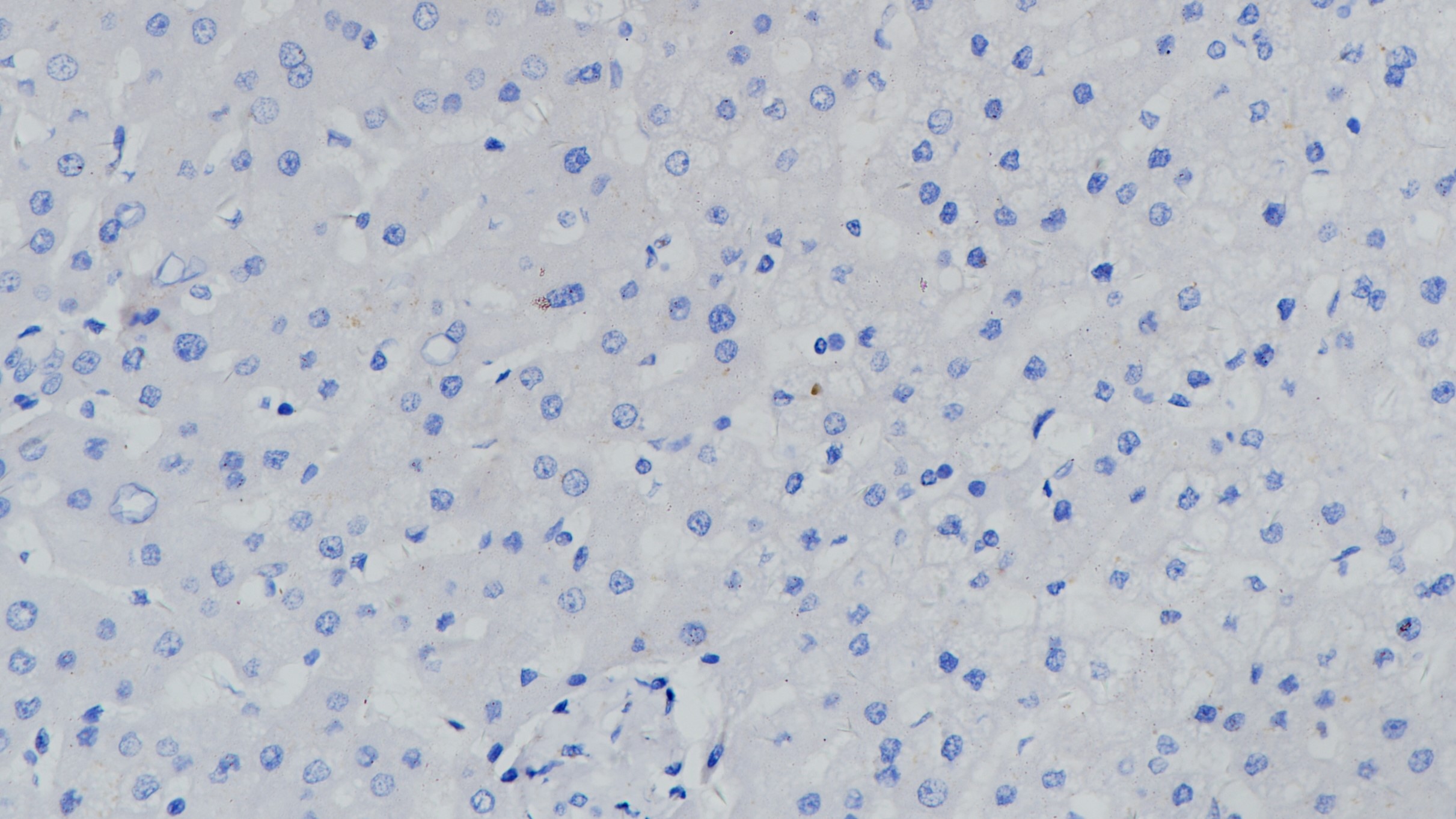 IgD(BP6134)肝脏 阴性组织染色