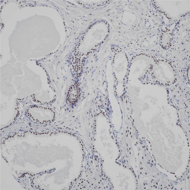 前列腺 AR (BP6126) 染色