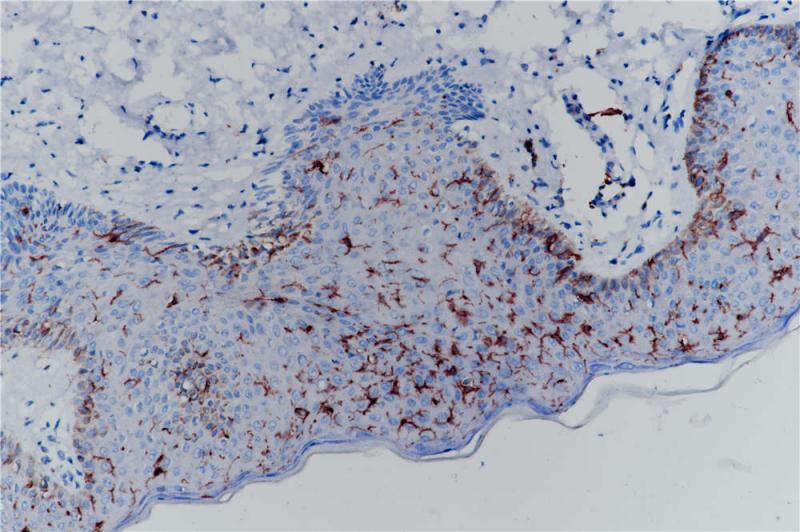皮肤 CD1a (BP6055) 染色