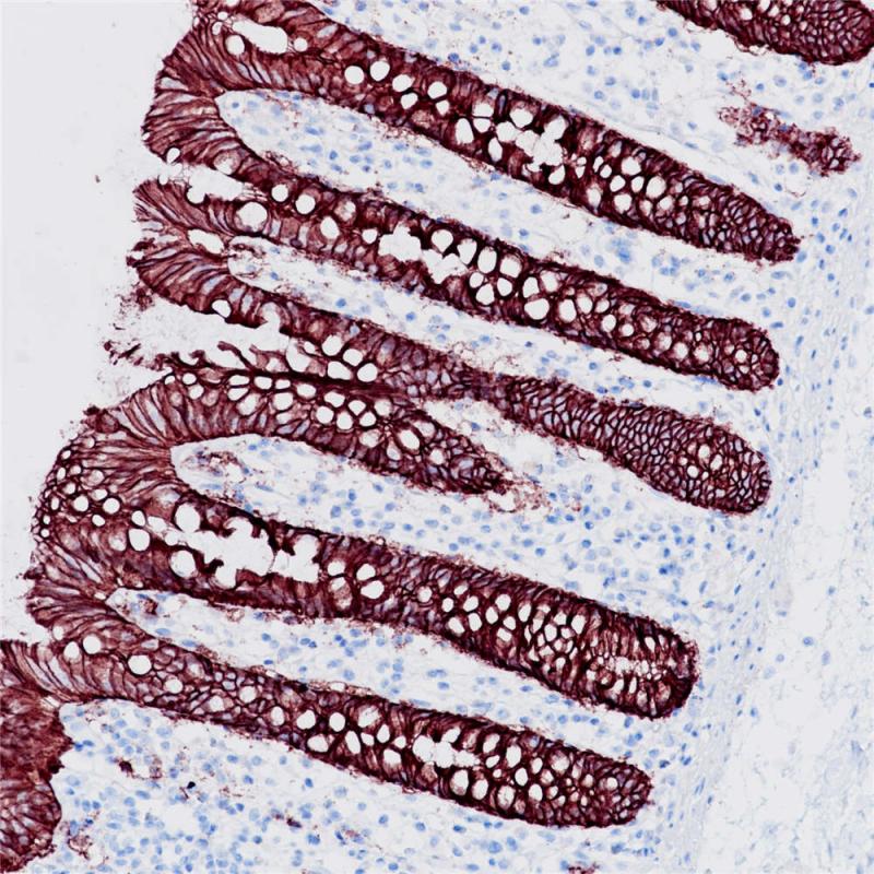 阑尾 EpCAM (BP6056) 染色