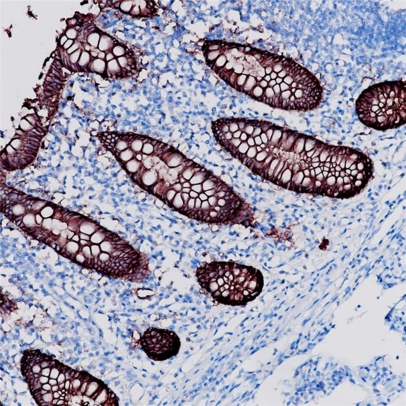 结肠 EpCAM (BP6056) 染色