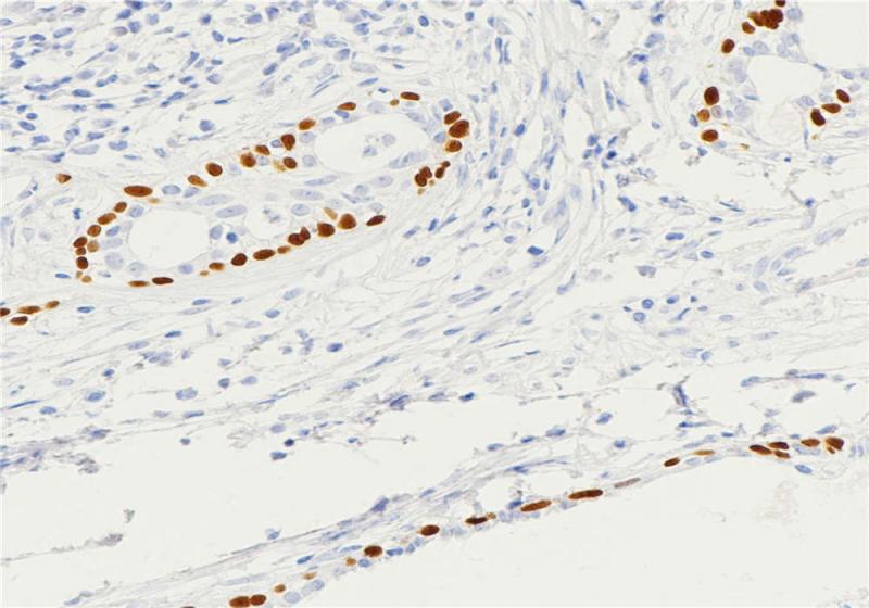 前列腺 p63 (BP6038) 染色