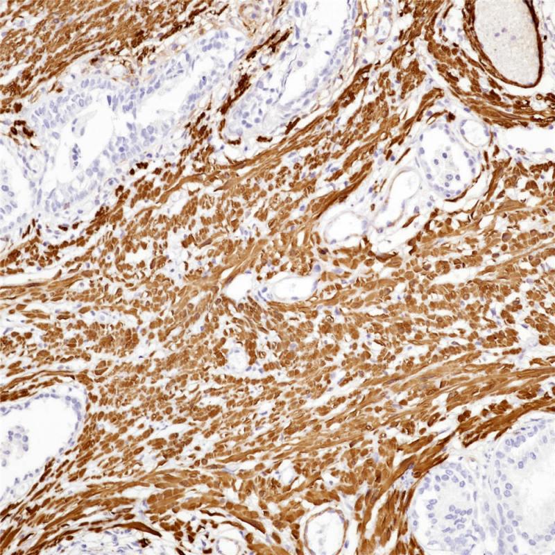 前列腺 Myosin,Smooth Muscle (BP6091) 染色