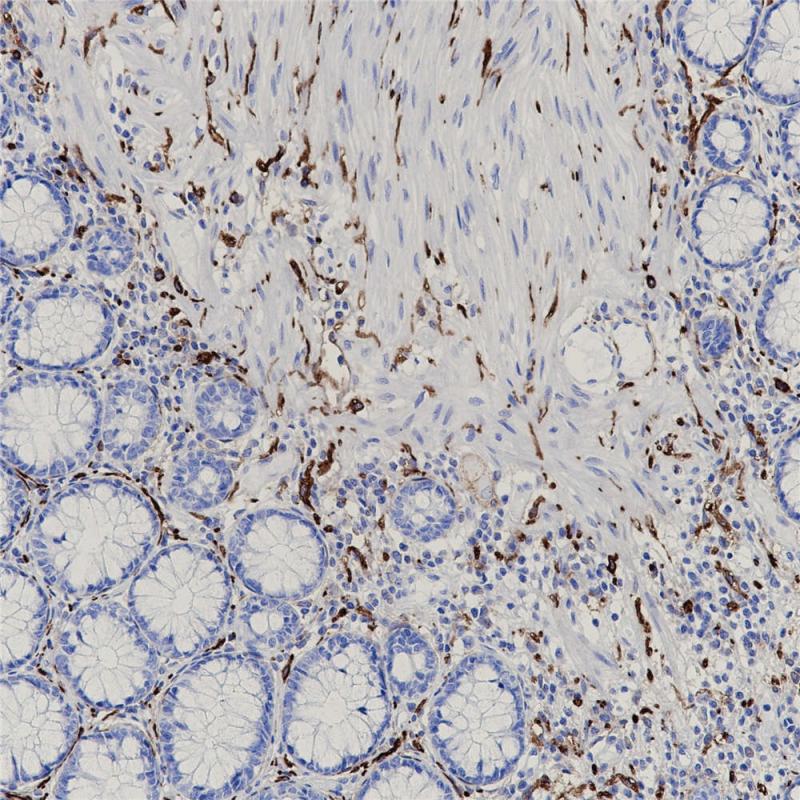 结肠 Podoplanin (BP6110) 染色