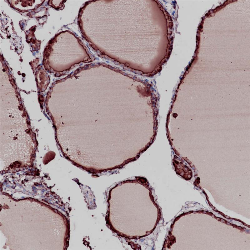 甲状腺 Thyroglobulin (BP6067) 染色