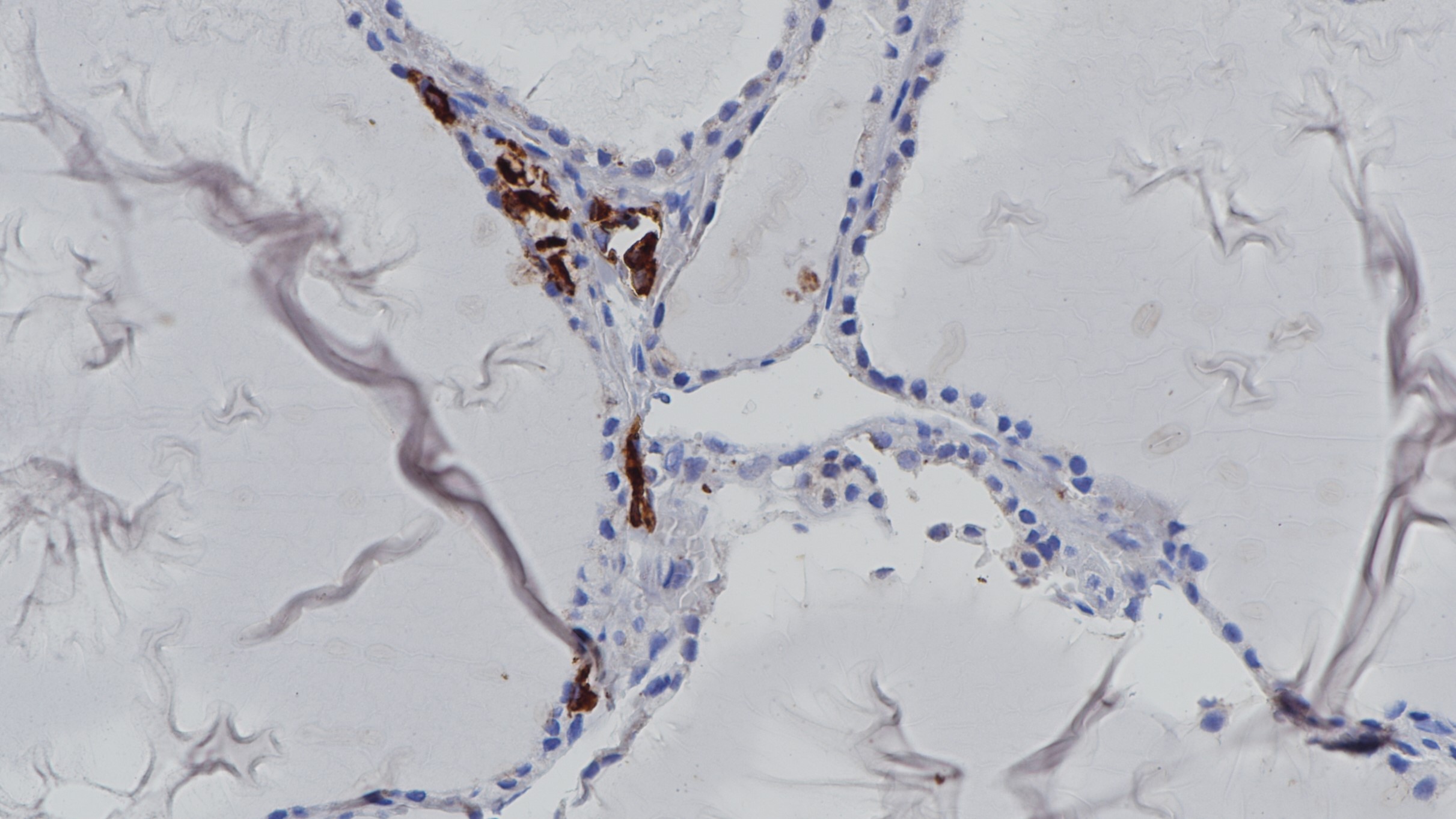 甲状腺Calcitonin(BP6128)染色