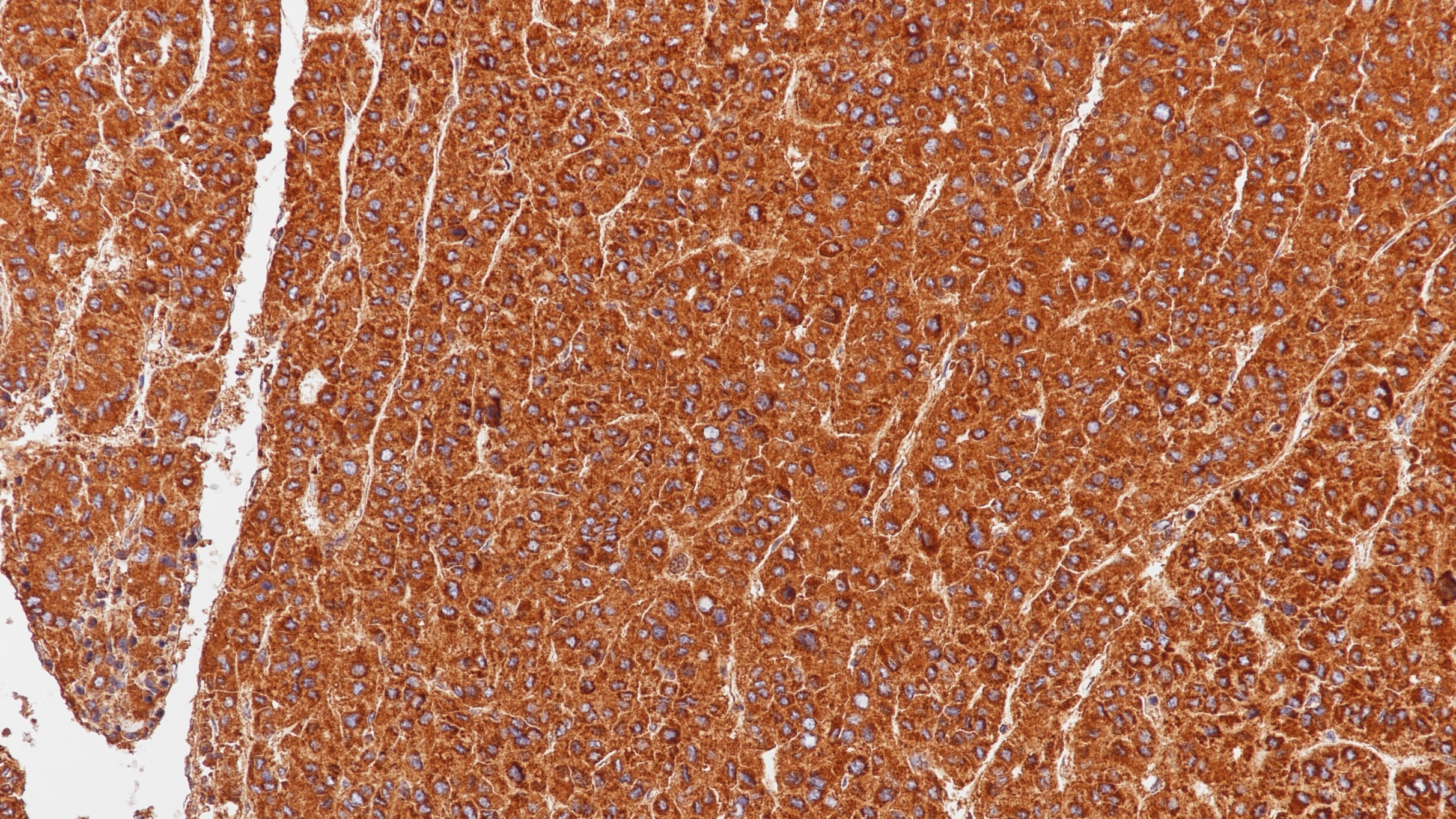 肝癌Hepatocyte(OCH1E5)染色