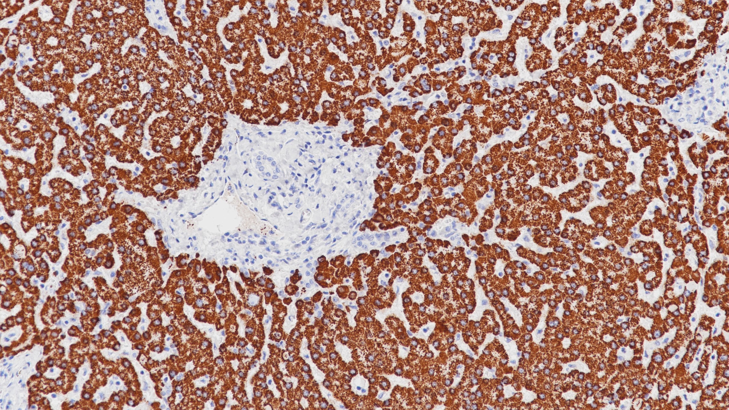肝Hepatocyte(OCH1E5)染色