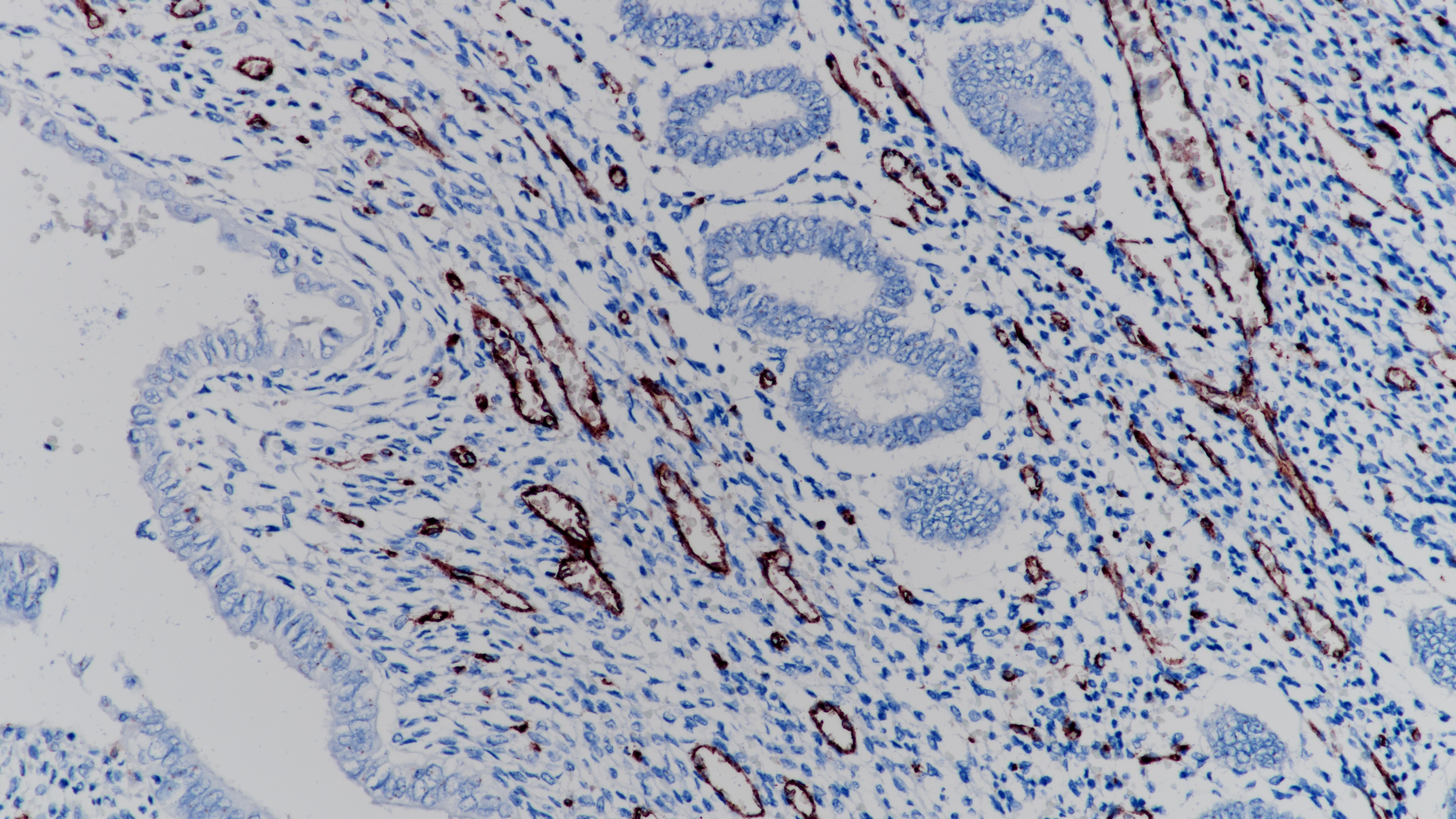 子宫CD31(BP6037)染色