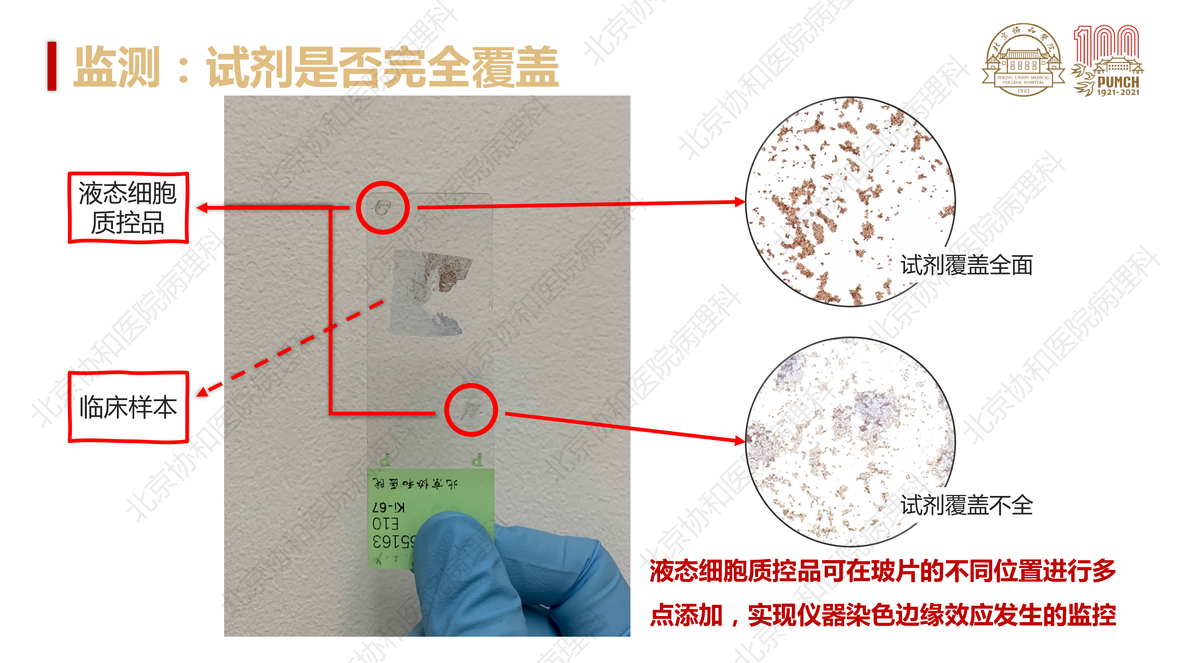 免疫组化室内质控要点解析及案例分享(2)-23.jpg