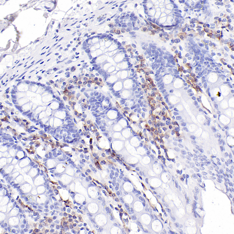 结肠BCMA(BP6211)染色