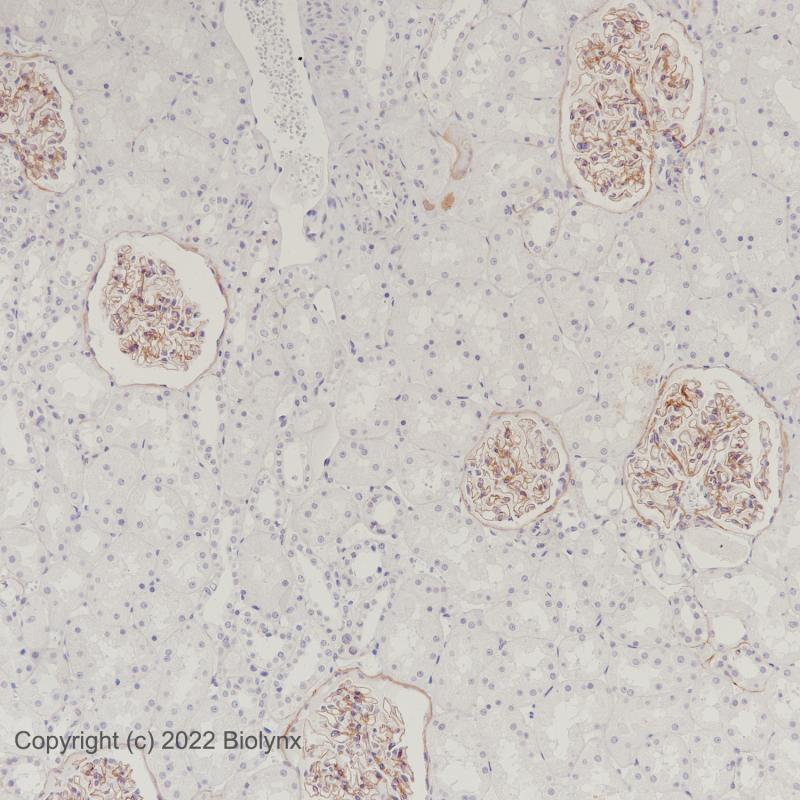 肾COL4A5(BP6206)染色-2