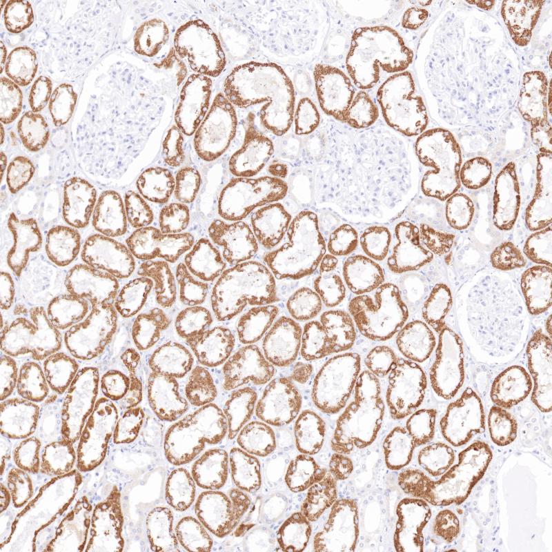 肾AMACR(BPM6227)染色