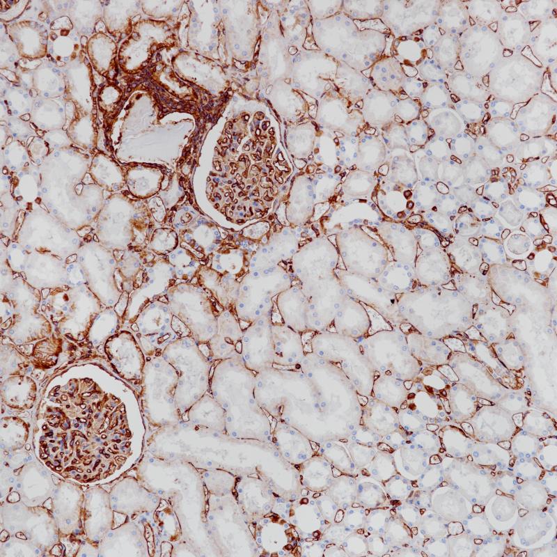 肾MHCⅠ(BP6234)染色