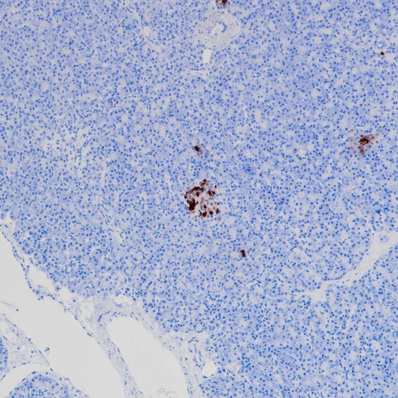 胰腺Somatostatin(BP6200)染色