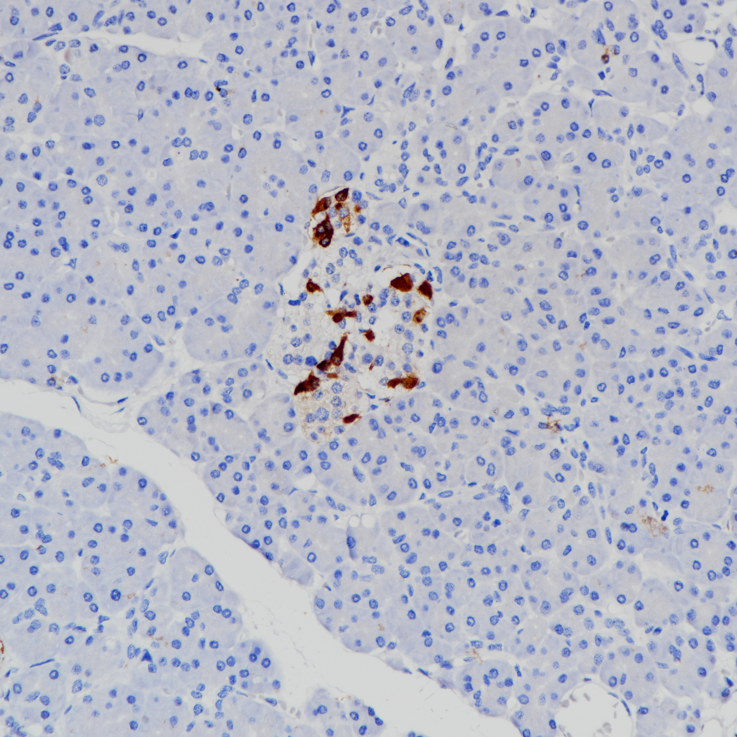 胰腺Somatostatin（BP6200）染色