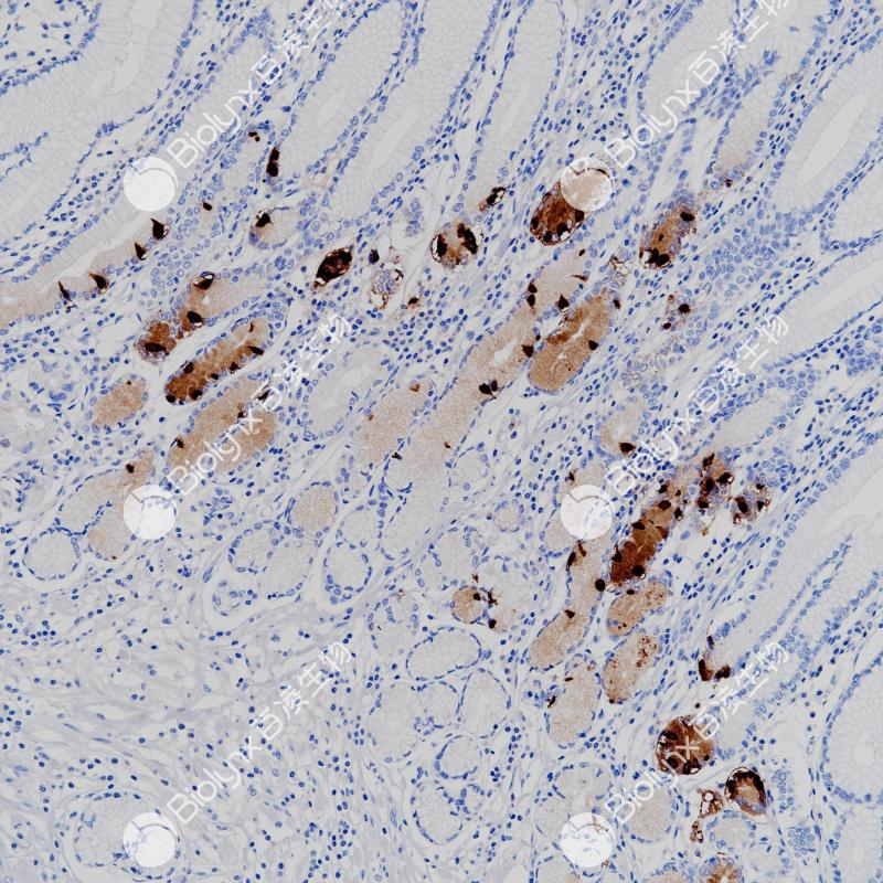 胃癌Gastrin（BP6253）染色