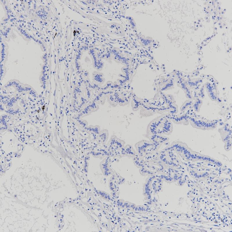 肺Claudin 18.2（BP6249）染色