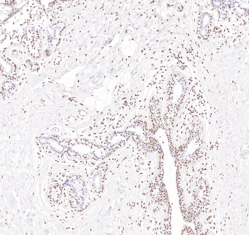 乳腺Estrogen receptor beta（BP6297）染色