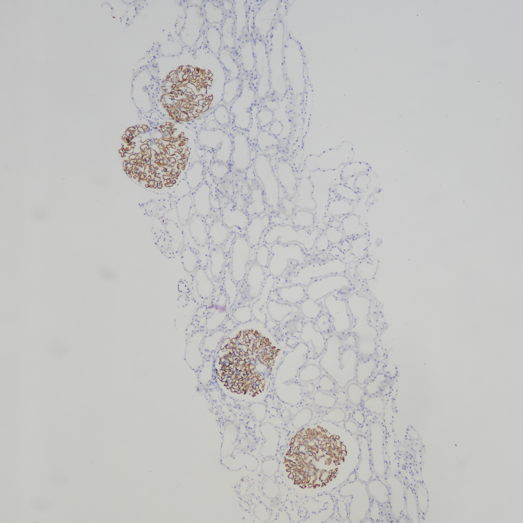 肾穿组织PLA2R(BP6284)染色