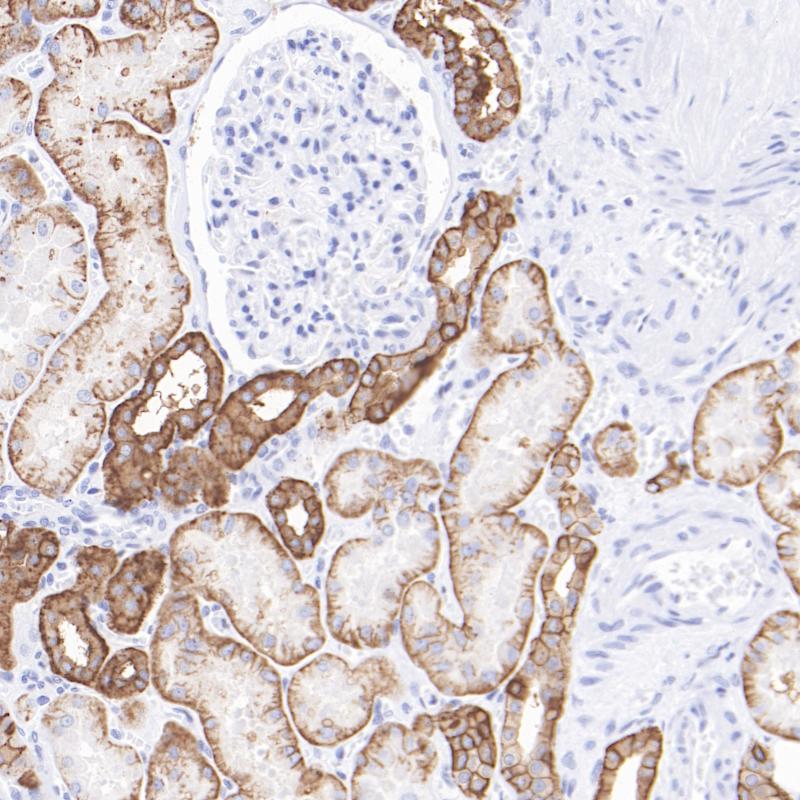 肾CA12（BP6318）染色