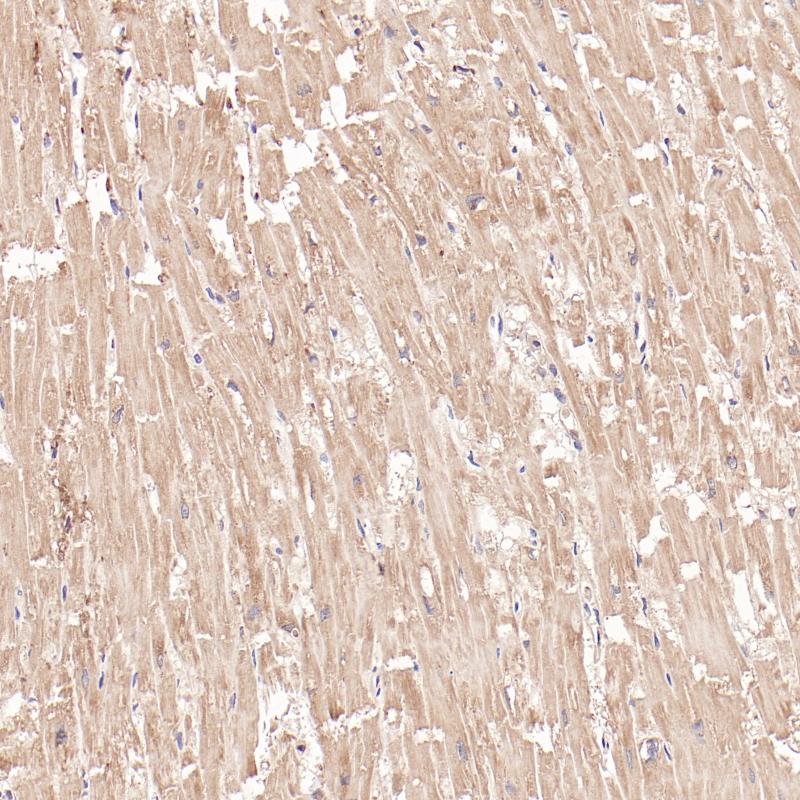 心脏FABP3（BP6313）染色