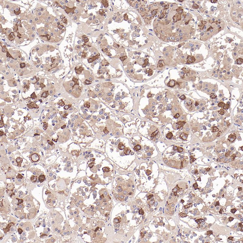 垂体LHβ(BP6328)染色