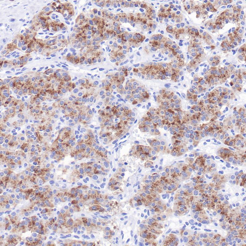 胰岛素瘤C-Peptide(BP6326)染色