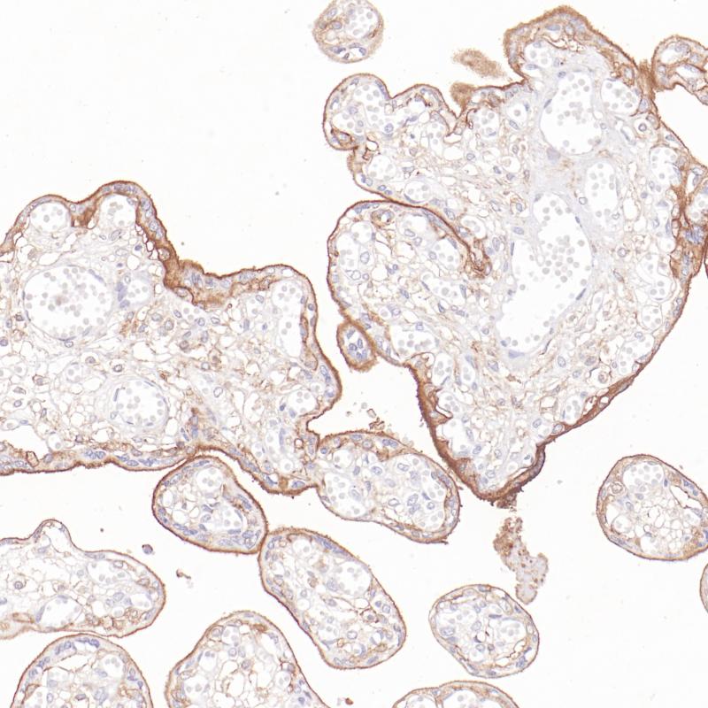 胎盘ANXA5(BP6331)染色