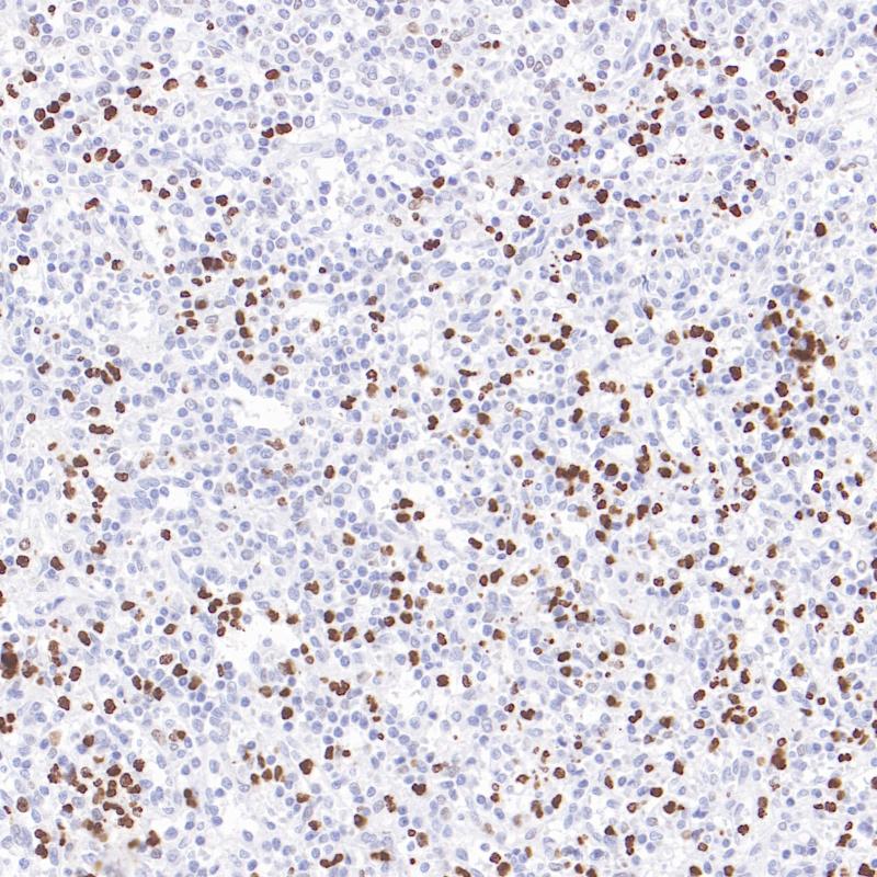 脾MNDA(BP6330)染色