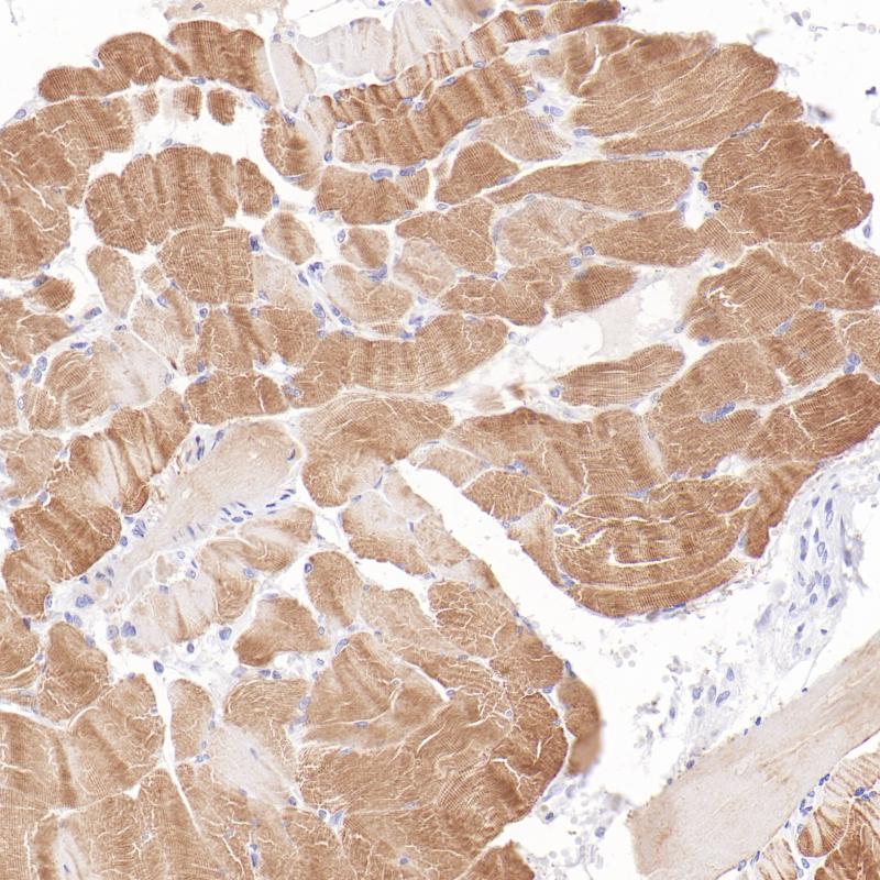 骨骼肌SkMA(BP6337)染色
